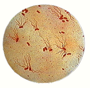 Bacteria tifoidea salmonella 