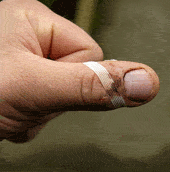 herida en un dedo